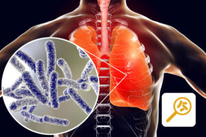 Legionella Plus Online Training Course