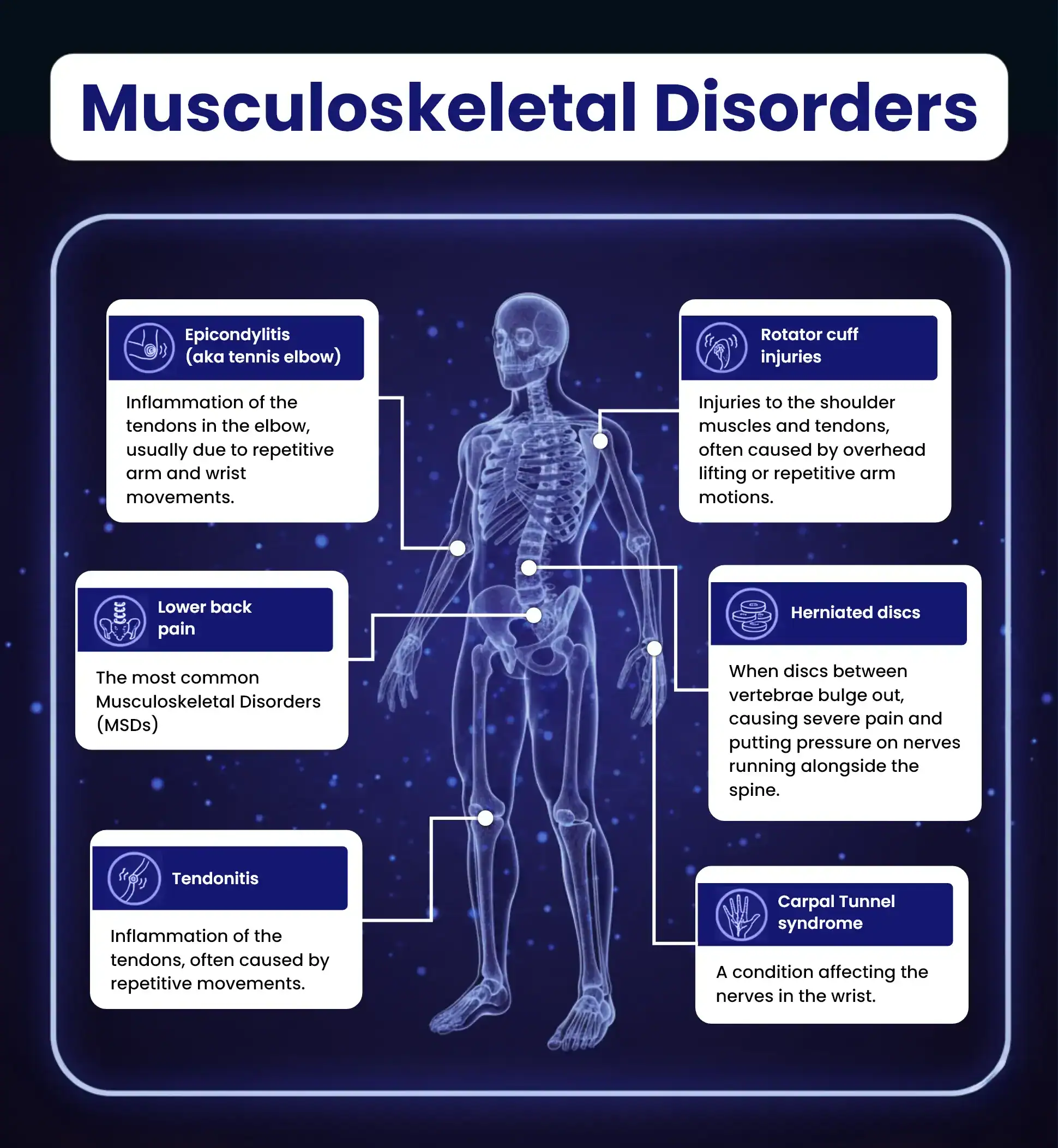 Musculoskeletal Disorders