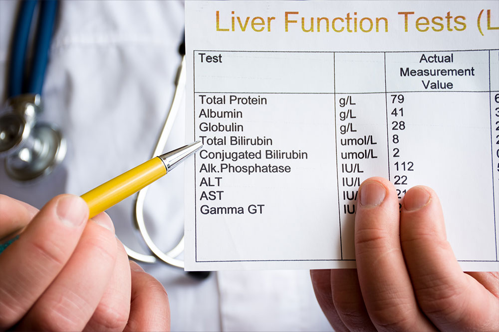 Tests for Elevated Liver Enzymes