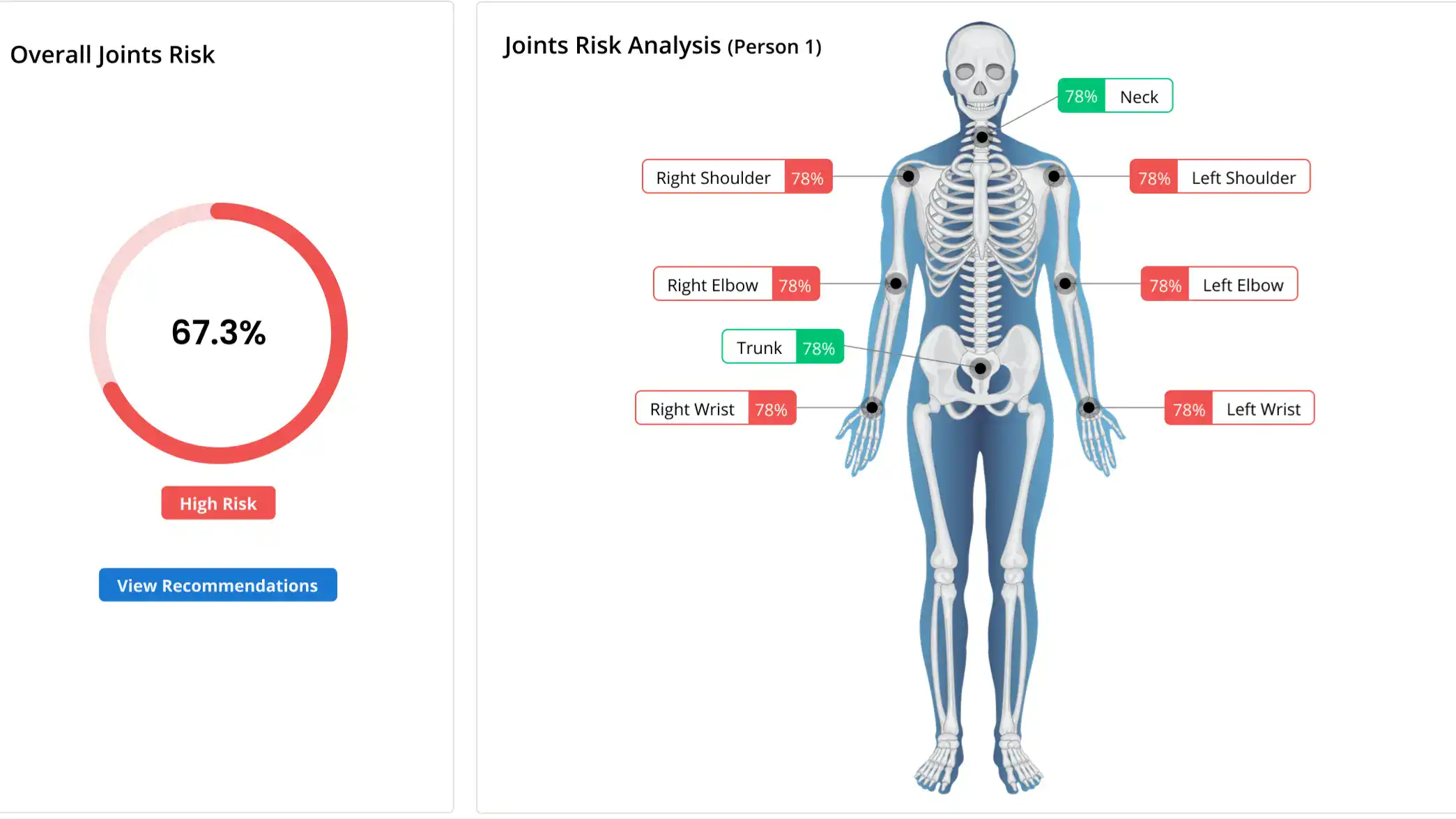 overall joints risk